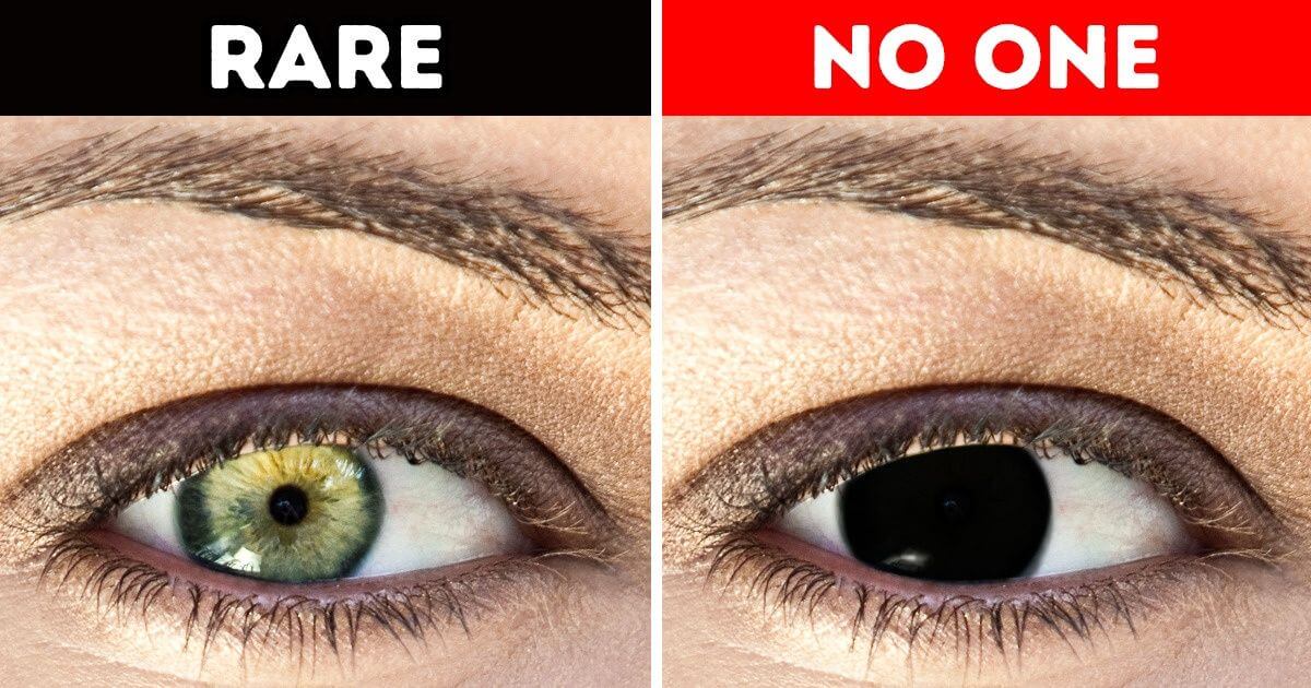 Why do humans have darker eyes with dark skin